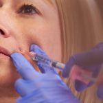 The Complete Guide to Dermal Fillers in Dubai: What You Need to Know